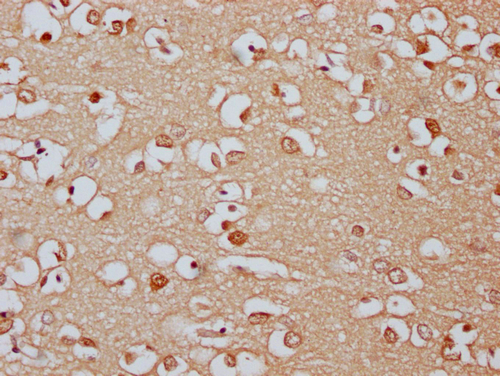 IHC image of CSB-PA897294LA01HU diluted at 1:300 and staining in paraffin-embedded human brain tissue performed on a Leica BondTM system. After dewaxing and hydration, antigen retrieval was mediated by high pressure in a citrate buffer (pH 6.0). Section was blocked with 10% normal goat serum 30min at RT. Then primary antibody (1% BSA) was incubated at 4°C overnight. The primary is detected by a Goat anti-rabbit IgG labeled by HRP and visualized using 0.05% DAB.