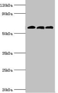 Western blot All lanes: 4-aminobutyrate aminotransferase, mitochondrial antibody at 10ug/ml Lane 1: Rat liver tissue Lane 2: Mouse pancreatic tissue Lane 3: Mouse kidney tissue Secondary Goat polyclonal to rabbit IgG at 1/10000 dilution Predicted band size: 56 kDa Observed band size: 56 kDa Western blot All lanes: 4-aminobutyrate aminotransferase, mitochondrial antibody at 10ug/ml Lane 1: Rat liver tissue Lane 2: Mouse pancreatic tissue Lane 3: Mouse kidney tissue Secondary Goat polyclonal to rabbit IgG at 1/10000 dilution Predicted band size: 56 kDa Observed band size: 56 kDa