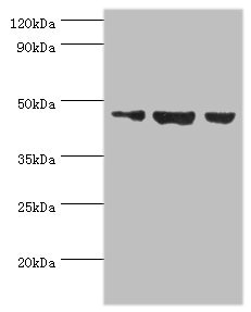 Western Blotting(WB) - ACTL6B Antibody