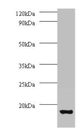 Western blot All lanes: V-type proton ATPase subunit G 1 antibody at 2microg/ml + 293T whole cell lysate Secondary Goat polyclonal to rabbit IgG at 1/15000 dilution Predicted band size: 14 kDa Observed band size: 14 kDa Western blot All lanes: V-type proton ATPase subunit G 1 antibody at 2microg/ml + 293T whole cell lysate Secondary Goat polyclonal to rabbit IgG at 1/15000 dilution Predicted band size: 14 kDa Observed band size: 14 kDa