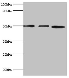 Western blot All lanes: Adenylosuccinate synthetase isozyme 2 antibody at 12ug/ml Lane 1: Mouse skeletal muscle tissue Lane 2: HepG2 whole cell lysate Lane 3: K562 whole cell lysate Secondary Goat polyclonal to rabbit IgG at 1/10000 dilution Predicted band size: 50 kDa Observed band size: 50 kDa