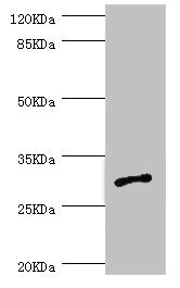 CSB-PA001450ESR2HU