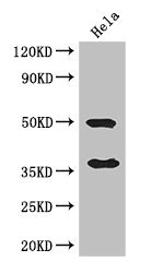 Western Blot Positive WB detected in: Hela whole cell lysate All lanes: AKR1B1 antibody at 3ug/ml Secondary Goat polyclonal to rabbit IgG at 1/50000 dilution Predicted band size: 36 kDa Observed band size: 36, 50 kDa Western Blot Positive WB detected in: Hela whole cell lysate All lanes: AKR1B1 antibody at 3ug/ml Secondary Goat polyclonal to rabbit IgG at 1/50000 dilution Predicted band size: 36 kDa Observed band size: 36, 50 kDa