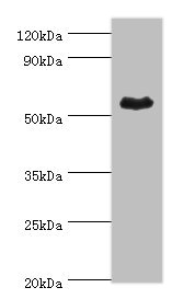 Western Blotting(WB) - ALDH1A1 Antibody