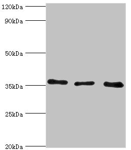 Western blot All lanes: Annexin A4 antibody at 4ug/ml Lane 1: 293T whole cell lysate Lane 2: Hela whole cell lysate Lane 3: HepG2 whole cell lysate Secondary Goat polyclonal to rabbit IgG at 1/10000 dilution Predicted band size: 36, 28 kDa Observed band size: 36 kDa Western blot All lanes: Annexin A4 antibody at 4ug/ml Lane 1: 293T whole cell lysate Lane 2: Hela whole cell lysate Lane 3: HepG2 whole cell lysate Secondary Goat polyclonal to rabbit IgG at 1/10000 dilution Predicted band size: 36, 28 kDa Observed band size: 36 kDa