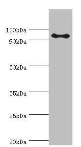 CSB-PA001871ESR1HU