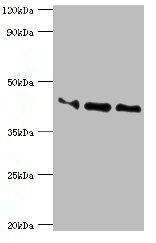 Western blot All lanes: Apolipoprotein L1 antibody at 10ug/ml Lane 1: A549 whole cell lysate Lane 2: Hela whole cell lysate Lane 3: HepG2 whole cell lysate Secondary Goat polyclonal to rabbit IgG at 1/10000 dilution Predicted band size: 44, 46, 43 kDa Observed band size: 44 kDa
