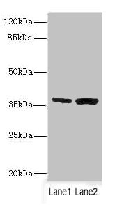 Western blot All lanes: C1GALT1C1 antibody at 3.97ug/ml Lane 1: Mouse gonadal tissue Lane 2: Mouse liver tissue Secondary Goat polyclonal to rabbit IgG at 1/10000 dilution Predicted band size: 36 kDa Observed band size: 36 kDa