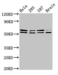 Western Blot Positive WB detected in: Hela whole cell lysate, 293 whole cell lysate, U87 whole cell lysate, Rat brain tissue All lanes: CD3EAP antibody at 3.9ug/ml Secondary Goat polyclonal to rabbit IgG at 1/50000 dilution Predicted band size: 55, 56 kDa Observed band size: 55, 56 kDa