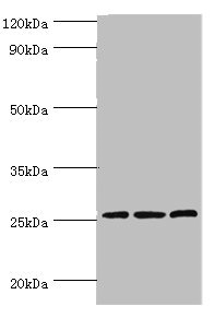 Western blot All lanes: Claudin-14 antibody at 4ug/ml Lane 1: Rat liver tissue Lane 2: Mouse kidney tissue Lane 3: Hela whole cell lysate Secondary Goat polyclonal to rabbit IgG at 1/10000 dilution Predicted band size: 26 kDa Observed band size: 26 kDa