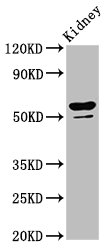 Western Blotting(WB) - CYP8B1 Antibody