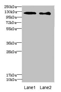 Western blot All lanes: DIAPH2 antibody at 4.75ug/ml Lane 1: 293T whole cell lysate Lane 2: Hela whole cell lysate Secondary Goat polyclonal to rabbit IgG at 1/10000 dilution Predicted band size: 126, 125 kDa Observed band size: 126 kDa