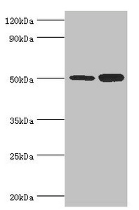 Western blot All lanes: Polycomb protein EED antibody at 4ug/ml Lane 1: Hela whole cell lysate Lane 2: K562 whole cell lysate Secondary Goat polyclonal to rabbit IgG at 1/10000 dilution Predicted band size: 51, 54, 46 kDa Observed band size: 51 kDa