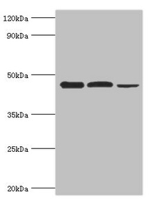 Western blot All lanes: Eukaryotic initiation factor 4A-I antibody at 3ug/ml Lane 1: K562 whole cell lysate Lane 2: Hela whole cell lysate Lane 3: Rat brain tissue Secondary Goat polyclonal to rabbit IgG at 1/10000 dilution Predicted band size: 47, 40 kDa Observed band size: 47 kDa Western blot All lanes: Eukaryotic initiation factor 4A-I antibody at 3ug/ml Lane 1: K562 whole cell lysate Lane 2: Hela whole cell lysate Lane 3: Rat brain tissue Secondary Goat polyclonal to rabbit IgG at 1/10000 dilution Predicted band size: 47, 40 kDa Observed band size: 47 kDa