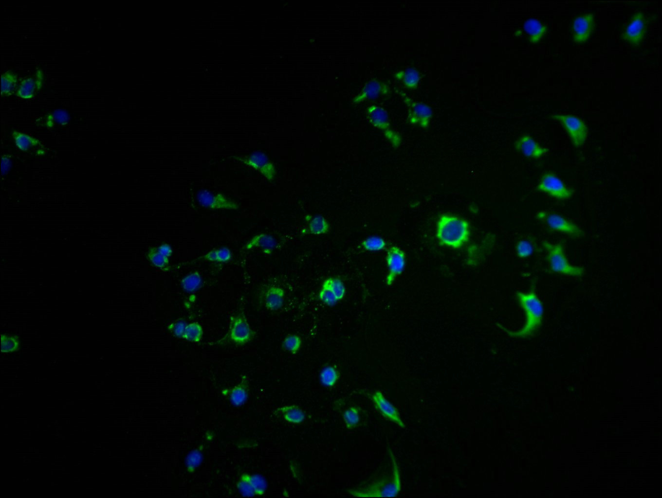 Immunofluorescence staining of A549 cells with CSB-PA008606LA01HU at 1:50, counter-stained with DAPI. The cells were fixed in 4% formaldehyde, permeabilized using 0.2% Triton X-100 and blocked in 10% normal Goat Serum. The cells were then incubated with the antibody overnight at 4°C. The secondary antibody was Alexa Fluor 488-congugated AffiniPure Goat Anti-Rabbit IgG(H+L).