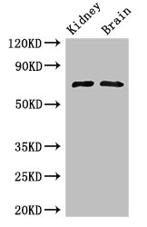 Western Blot Positive WB detected in: Mouse kidney tissue, Mouse brain tissue All lanes: GAA Antibody at 3ug/ml Secondary Goat polyclonal to rabbit IgG at 1/50000 dilution Predicted band size: 70, 76, 106 kDa Observed band size: 70 kDa