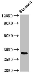Western Blot Positive WB detected in: Rat stomach tissue All lanes: GCLM antibody at 3ug/ml Secondary Goat polyclonal to rabbit IgG at 1/50000 dilution Predicted band size: 31, 29 kDa Observed band size: 31 kDa
