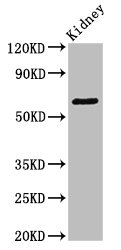 Western Blot Positive WB detected in: Mouse kidney tissue All lanes: GRK5 antibody at 3.4ug/ml Secondary Goat polyclonal to rabbit IgG at 1/50000 dilution Predicted band size: 68 kDa Observed band size: 68 kDa