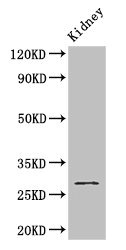 Western Blot Positive WB detected in: Mouse kidney tissue All lanes: GSTM3 antibody at 2.8ug/ml Secondary Goat polyclonal to rabbit IgG at 1/50000 dilution Predicted band size: 27 kDa Observed band size: 27 kDa