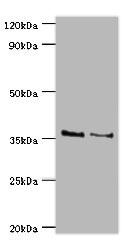 Western blot All lanes: HOXA1 antibody at 2ug/ml Lane 1: NIH/3T3 whole cell lysate Lane 2: Hela whole cell lysate Secondary Goat polyclonal to rabbit IgG at 1/10000 dilution Predicted band size: 37, 15, 25 kDa Observed band size: 37 kDa Western blot All lanes: HOXA1 antibody at 2ug/ml Lane 1: NIH/3T3 whole cell lysate Lane 2: Hela whole cell lysate Secondary Goat polyclonal to rabbit IgG at 1/10000 dilution Predicted band size: 37, 15, 25 kDa Observed band size: 37 kDa