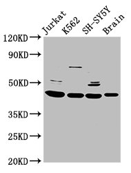 Western Blot Positive WB detected in: Jurkat whole cell lysate, K562 whole cell lysate, SH-SY5Y whole cell lysate, Rat brain tissue All lanes: HOXD3 antibody at 8.5ug/ml Secondary Goat polyclonal to rabbit IgG at 1/50000 dilution Predicted band size: 46 kDa Observed band size: 46 kDa Western Blot Positive WB detected in: Jurkat whole cell lysate, K562 whole cell lysate, SH-SY5Y whole cell lysate, Rat brain tissue All lanes: HOXD3 antibody at 8.5ug/ml Secondary Goat polyclonal to rabbit IgG at 1/50000 dilution Predicted band size: 46 kDa Observed band size: 46 kDa