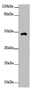Western blot All lanes: HS6ST1 antibody at 2 ug/ml + Mouse skeletal muscle tissue Secondary Goat polyclonal to rabbit IgG at 1/10000 dilution Predicted band size: 49, 30 kDa Observed band size: 49 kDa Western blot All lanes: HS6ST1 antibody at 2 ug/ml + Mouse skeletal muscle tissue Secondary Goat polyclonal to rabbit IgG at 1/10000 dilution Predicted band size: 49, 30 kDa Observed band size: 49 kDa