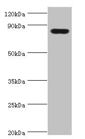 Western blot All lanes: Peroxisomal multifunctional enzyme type 2 antibody at 3ug/ml + Mouse liver tissue Secondary Goat polyclonal to rabbit IgG at 1/10000 dilution Predicted band size: 80, 84, 78 kDa Observed band size: 80 kDa Western blot All lanes: Peroxisomal multifunctional enzyme type 2 antibody at 3ug/ml + Mouse liver tissue Secondary Goat polyclonal to rabbit IgG at 1/10000 dilution Predicted band size: 80, 84, 78 kDa Observed band size: 80 kDa