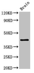 Western Blot Positive WB detected in: Mouse brain tissue All lanes: IGHD antibody at 3ug/ml Secondary Goat polyclonal to rabbit IgG at 1/50000 dilution Predicted band size: 43, 38 kDa Observed band size: 43 kDa