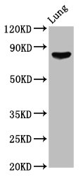 Western Blotting(WB) - ITGB6 Antibody
