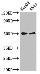 Western Blotting(WB) - KIR3DL1 Antibody