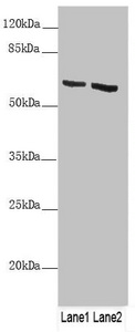 Western blot All lanes: KRT6B antibody at 4.29 ug/ml Lane 1: A431 whole cell lysate Lane 2: A375 whole cell lysate Secondary Goat polyclonal to rabbit IgG at 1/10000 dilution Predicted band size: 60 kDa Observed band size: 60 kDa Western blot All lanes: KRT6B antibody at 4.29 ug/ml Lane 1: A431 whole cell lysate Lane 2: A375 whole cell lysate Secondary Goat polyclonal to rabbit IgG at 1/10000 dilution Predicted band size: 60 kDa Observed band size: 60 kDa