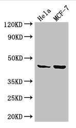 Western Blot Positive WB detected in: Hela whole cell lysate, MCF-7 whole cell lysate All lanes: MAP2K4 antibody at 3.25ug/ml Secondary Goat polyclonal to rabbit IgG at 1/50000 dilution Predicted band size: 45, 46 kDa Observed band size: 45 kDa