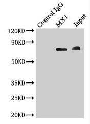 Immunoprecipitating MX1 in Hela whole cell lysate Lane 1: Rabbit control IgG instead of (1ug) instead of CSB-PA015249LA01HU in Hela whole cell lysate. For western blotting, a HRP-conjugated light chain specific antibody was used as the Secondary antibody (1/50000) Lane 2: CSB-PA015249LA01HU (4ug) + Hela whole cell lysate (500ug) Lane 3: Hela whole cell lysate (20ug)