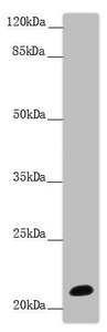 Western blot All lanes: NCALD antibody at 9.32 ug/ml + Mouse brain tissue Secondary Goat polyclonal to rabbit IgG at 1/10000 dilution Predicted band size: 22 kDa Observed band size: 22 kDa Western blot All lanes: NCALD antibody at 9.32 ug/ml + Mouse brain tissue Secondary Goat polyclonal to rabbit IgG at 1/10000 dilution Predicted band size: 22 kDa Observed band size: 22 kDa