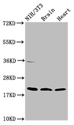 Western Blot Positive WB detected in: NIH/3T3 whole cell lysate, Rat brain tissue, Mouse heart tissue All lanes: NDUFB8 antibody at 2ug/ml Secondary Goat polyclonal to rabbit IgG at 1/50000 dilution Predicted band size: 22, 21, 19 kDa Observed band size: 22 kDa Western Blot Positive WB detected in: NIH/3T3 whole cell lysate, Rat brain tissue, Mouse heart tissue All lanes: NDUFB8 antibody at 2ug/ml Secondary Goat polyclonal to rabbit IgG at 1/50000 dilution Predicted band size: 22, 21, 19 kDa Observed band size: 22 kDa