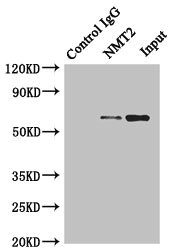 CSB-PA015901DSR1HU SDS