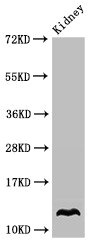 Western Blot Positive WB detected in: Mouse kidney tissue All lanes: OXT antibody at 3.4ug/ml Secondary Goat polyclonal to rabbit IgG at 1/50000 dilution Predicted band size: 13 kDa Observed band size: 13 kDa