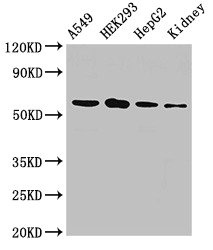 Western Blot Positive WB detected in: A549 whole cell lysate, HEK293 whole cell lysate, HepG2 whole cell lysate, Rat kidney tissue All lanes: P4HA1 antibody at 2.5ug/ml Secondary Goat polyclonal to rabbit IgG at 1/50000 dilution Predicted band size: 62, 61, 59 kDa Observed band size: 62 kDa