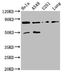 Western Blot Positive WB detected in: Hela whole cell lysate, A549 whole cell lysate, U251 whole cell lysate, Mouse lung tissue All lanes: Pcsk1 antibody at 8ug/ml Secondary Goat polyclonal to rabbit IgG at 1/50000 dilution Predicted band size: 85 kDa Observed band size: 85 kDa Western Blot Positive WB detected in: Hela whole cell lysate, A549 whole cell lysate, U251 whole cell lysate, Mouse lung tissue All lanes: Pcsk1 antibody at 8ug/ml Secondary Goat polyclonal to rabbit IgG at 1/50000 dilution Predicted band size: 85 kDa Observed band size: 85 kDa