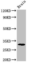 Western Blot Positive WB detected in: Rat brain tissue All lanes: Pdxp antibody at 2.8ug/ml Secondary Goat polyclonal to rabbit IgG at 1/50000 dilution Predicted band size: 32 kDa Observed band size: 32 kDa Western Blot Positive WB detected in: Rat brain tissue All lanes: Pdxp antibody at 2.8ug/ml Secondary Goat polyclonal to rabbit IgG at 1/50000 dilution Predicted band size: 32 kDa Observed band size: 32 kDa