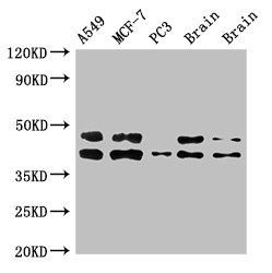 Western Blot Positive WB detected in: A549 whole cell lysate, MCF-7 whole cell lysate, PC-3 whole cell lysate, Rat brain tissue, Mouse brain tissue All lanes: PRKACB antibody at 3ug/ml Secondary Goat polyclonal to rabbit IgG at 1/50000 dilution Predicted band size: 41, 47, 40, 42, 30, 37 kDa Observed band size: 41, 47 kDa