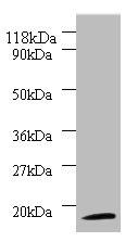 Western blot All lanes: 40S ribosomal protein S11 antibody at 2ug/ml + 293T whole cell lysate Secondary Goat polyclonal to rabbit IgG at 1/10000 dilution Predicted band size: 18 kDa Observed band size: 18 kDa Western blot All lanes: 40S ribosomal protein S11 antibody at 2ug/ml + 293T whole cell lysate Secondary Goat polyclonal to rabbit IgG at 1/10000 dilution Predicted band size: 18 kDa Observed band size: 18 kDa