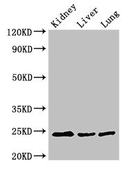 Western Blot Positive WB detected in: Mouse kidney tissue, Mouse liver tissue, Rat lung tissue All lanes: RAB5A antibody at 3ug/ml Secondary Goat polyclonal to rabbit IgG at 1/50000 dilution Predicted band size: 24, 23 kDa Observed band size: 24 kDa Western Blot Positive WB detected in: Mouse kidney tissue, Mouse liver tissue, Rat lung tissue All lanes: RAB5A antibody at 3ug/ml Secondary Goat polyclonal to rabbit IgG at 1/50000 dilution Predicted band size: 24, 23 kDa Observed band size: 24 kDa