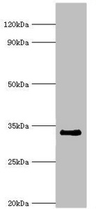 Western blot All lanes: Cell cycle checkpoint protein RAD1 antibody at 6ug/ml + NIH/3T3 whole cell lysate Secondary Goat polyclonal to rabbit IgG at 1/10000 dilution Predicted band size: 32, 28, 8 kDa Observed band size: 32 kDa Western blot All lanes: Cell cycle checkpoint protein RAD1 antibody at 6ug/ml + NIH/3T3 whole cell lysate Secondary Goat polyclonal to rabbit IgG at 1/10000 dilution Predicted band size: 32, 28, 8 kDa Observed band size: 32 kDa