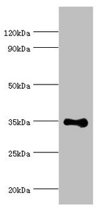 Western Blotting(WB) - RAD51D Antibody