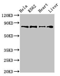Western Blot Positive WB detected in: Hela whole cell lysate, K562 whole cell lysate, Mouse heart tissue, Rat liver tissue All lanes: RGL2 antibody at 3.2ug/ml Secondary Goat polyclonal to rabbit IgG at 1/50000 dilution Predicted band size: 84, 51 kDa Observed band size: 84 kDa