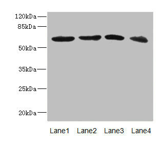 Western blot All lanes: RGS14 antibody at 3.88ug/ml Lane 1: 293T whole cell lysate Lane 2: Hela whole cell lysate Lane 3: Jurkat whole cell lysate Lane 4: SH-SY5Y whole cell lysate Secondary Goat polyclonal to rabbit IgG at 1/10000 dilution Predicted band size: 62, 22, 45, 37 kDa Observed band size: 62 kDa Western blot All lanes: RGS14 antibody at 3.88ug/ml Lane 1: 293T whole cell lysate Lane 2: Hela whole cell lysate Lane 3: Jurkat whole cell lysate Lane 4: SH-SY5Y whole cell lysate Secondary Goat polyclonal to rabbit IgG at 1/10000 dilution Predicted band size: 62, 22, 45, 37 kDa Observed band size: 62 kDa