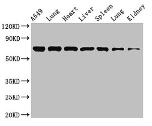 Western Blot Positive WB detected in: A549 whole cell lysate, Rat lung tissue, Mouse heart tissue, Mouse liver tissue, Mouse spleen tissue, Mouse lung tissue, Mouse kidney tissue All lanes: RPA1 antibody at 3.4microg/ml Secondary Goat polyclonal to rabbit IgG at 1/50000 dilution Predicted band size: 69 kDa Observed band size: 69 kDa