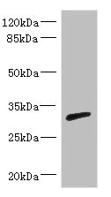 Western blot All lanes: RPIA antibody IgG at 3.29ug/ml + Mouse kidney tissue Secondary Goat polyclonal to rabbit IgG at 1/10000 dilution Predicted band size: 33 kDa Observed band size: 33 kDa Western blot All lanes: RPIA antibody IgG at 3.29ug/ml + Mouse kidney tissue Secondary Goat polyclonal to rabbit IgG at 1/10000 dilution Predicted band size: 33 kDa Observed band size: 33 kDa