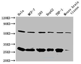Western Blot Positive WB detected in: Mouse spleen tissue All lanes: RPL19 antibody at 2ug/ml Secondary Goat polyclonal to rabbit IgG at 1/50000 dilution Predicted band size: 24 kDa Observed band size: 24 kDa Western Blot Positive WB detected in: Mouse spleen tissue All lanes: RPL19 antibody at 2ug/ml Secondary Goat polyclonal to rabbit IgG at 1/50000 dilution Predicted band size: 24 kDa Observed band size: 24 kDa